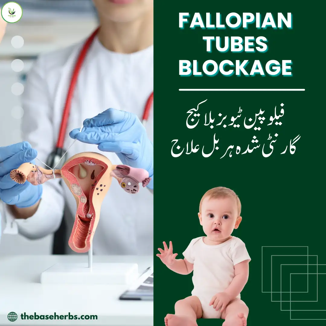 فیلوپین ٹیوبز بلاکیج